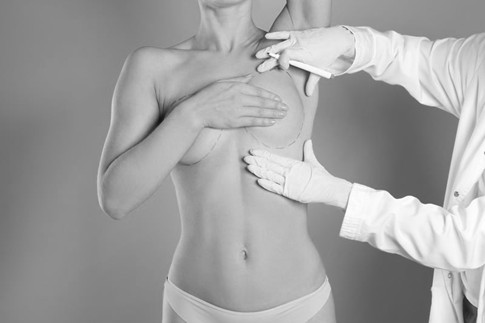 revision breast reconstruction surgery newcastle